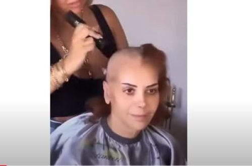 Xərçəngdən əziyyət çəkən müğənni saçlarını qırxdırdı - VİDEO