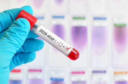 Azərbaycanda son 1 həftə ərzində koronavirusa yoluxanların sayı açıqlanıb