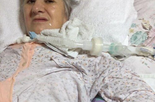 Həkim qadının səhv yumurtalığını götürdü: 