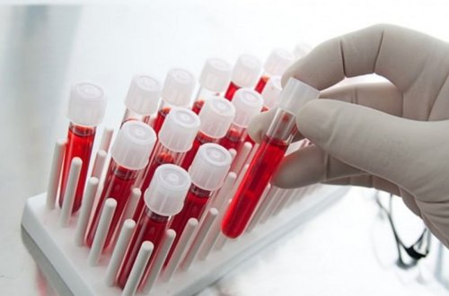 Azərbaycanda talassemiyalı xəstələrin sayı açıqlanıb