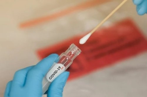 ÜST: Covid-19-a yoluxma sayı artmaqdadır