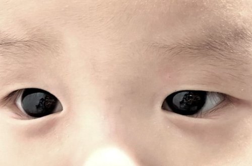 Covid-19 müalicəsi alan körpənin göz rəngi dəyişdi – qəribə hadisə