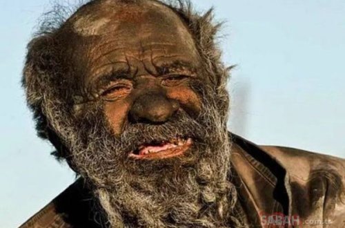 65 ildir yuyunmayan adam duş qəbul etdikdən sonra dünyasını dəyişib.