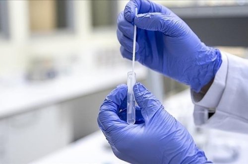 Türkiyədə “Eris” virusuna 9 nəfər yoluxdu