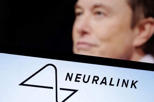 İlon Mask beyin implantlarının klinik sınaqları üçün könüllülər axtarır