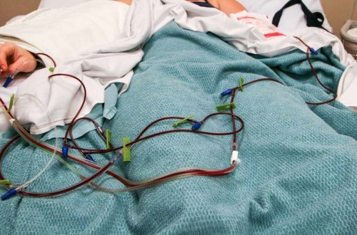 Sümük iliyi transplantasiyası cərrahi müdaxilə olmadan həyata keçiriləcək