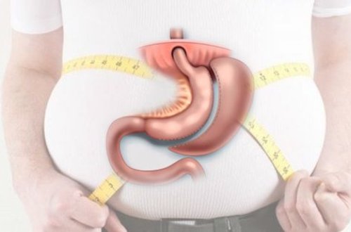 Mədəkiçiltmə əməliyyatları nəticəsində ölüm belə qaçılmaz olur - Həkimdən ÇAĞIRIŞ