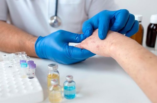 Şəkidə qızılca infeksiyası yayılıb - Nazirlik