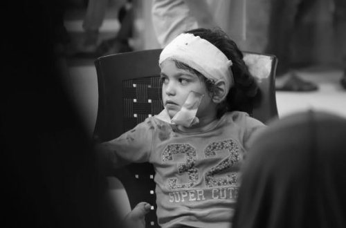 UNICEF-dən dəhşətli açıqlama: Hər gün 400-dən çox uşaq ölür