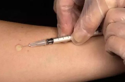 Ağcaqanadlarla ötürülən virusa qarşı ilk peyvəndin təsdiqlənib