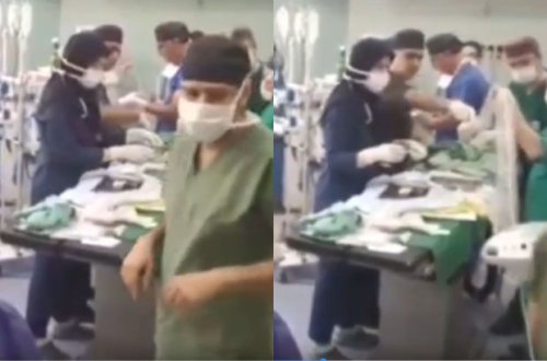 İranda siam əkizlərinin ayrılması əməliyyatı keçirilib - VİDEO