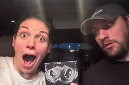 İkiqat uşaqlığı olan qadın eyni anda iki ayrı körpəyə hamilə qalıb