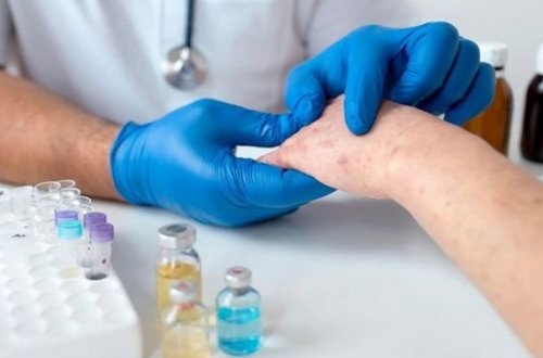 Azərbaycanda bir universitetin 8 tələbəsi qızılcaya yoluxub