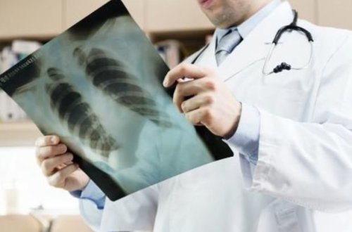 Pakistanda son 10 gündə 42 uşaq ölüb - SƏBƏB