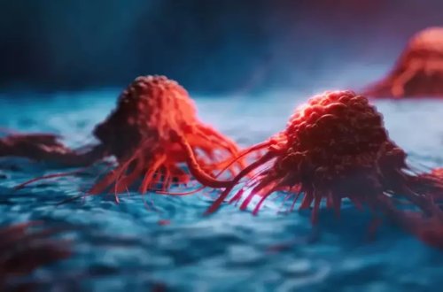 ÜST-dən qorxulu xərçəng proqnozu: 77 faiz artım olacaq