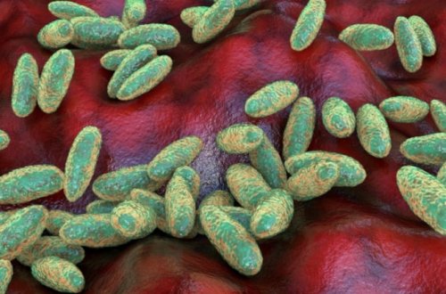 İllər sonra məlum oldu: Bubon taunu aşkarlandı