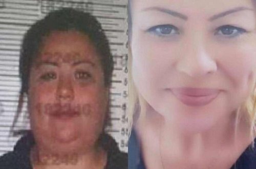 Əməliyyatla üzünü dəyişdirib dələduzluq etdi - FOTO