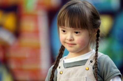 Azərbaycanda iki minə yaxın daun sindromlu əlilliyi olan şəxs var