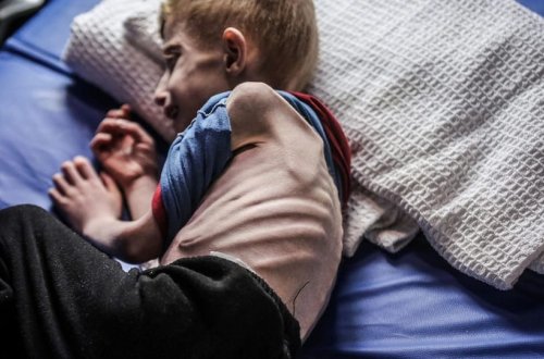 ÜST Qəzzada müalicə üçün evakuasiya edilməli 8 min xəstə olduğunu açıqlayıb