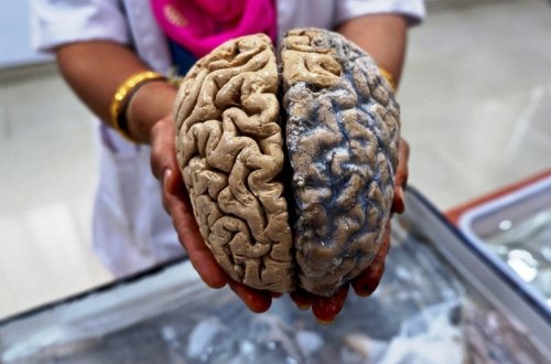 Beyin üçün koronavirusdan təhlükəli olan infeksiya açıqlanıb