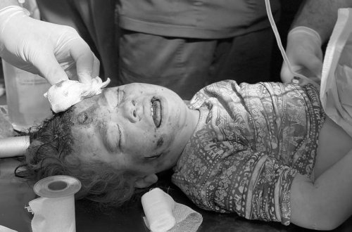 Qəzzada ölənlərin sayı 33 mini keçdi