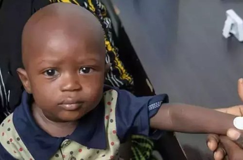 Qambiyada aparılan mikro iynə yamaq peyvəndi sınağının nəticələri uğurlu olub