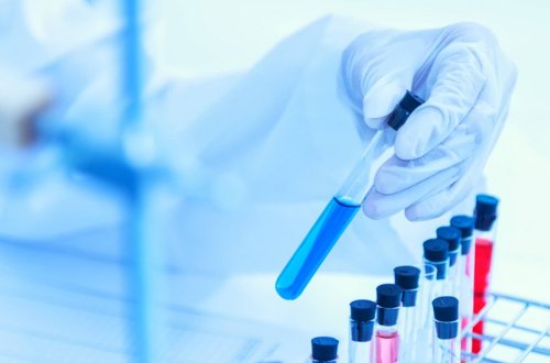 Xaricdəki Azərbaycan vətəndaşlarının nikahla əlaqədar tibbi müayinədən keçmələrinə görə yeni qayda ilk oxunuşda təsdiqlənib