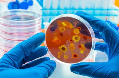 ÜST-dən SOS - Yeni epidemiya GƏLİR