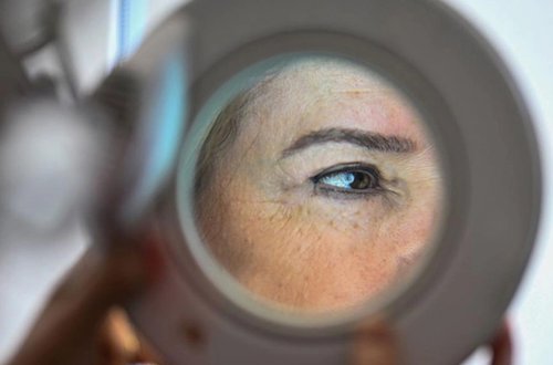 Bu amillər dəri xərçənginə yol aça bilər - Mütəxəssislərdən XƏBƏRDARLIQ