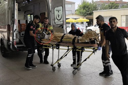 13 yaşlı uşağın qolu doğrama maşınına ilişdi