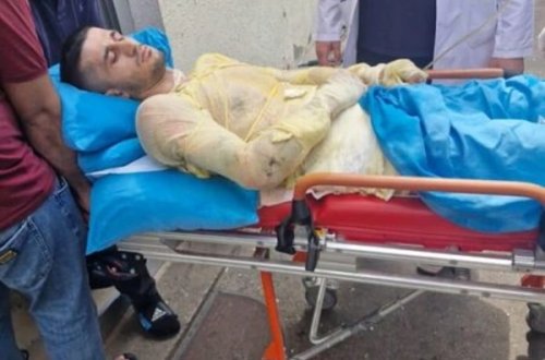 Qız qaçıran qazi özünü yandırıb - TƏFƏRRÜAT - FOTO