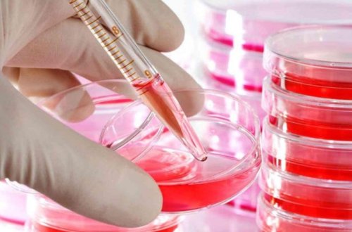 Ötən altı ay ərzində Azərbaycanda 736 nəfər İİV-ə yoluxub