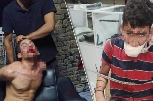 Dəhşətli hadisə - Kəlbətinlə dişlərini çıxardıb tarakan yedizdirdilər