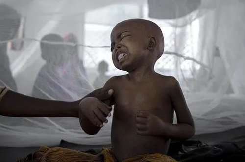 Nigeriyada vəba epidemiyası yayılıb: 156 ÖLÜ