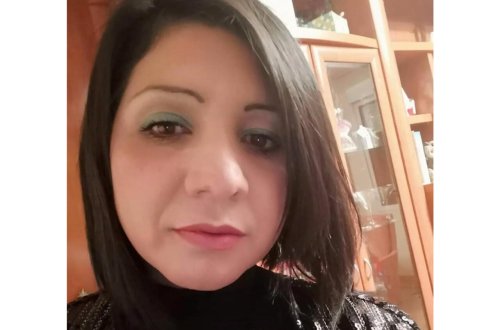 2 uşaq anası estetik əməliyyat zamanı öldü - FOTO