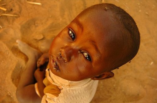 Sudanda 26 milyon insan kəskin aclıqdan əziyyət çəkir
