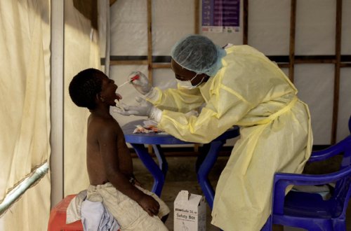 ÜST “meymunçiçəyi” ilə bağlı fövqəladə vəziyyət elan etdi