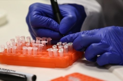 Pakistanda 3 nəfərdə M virusu aşkar edilib