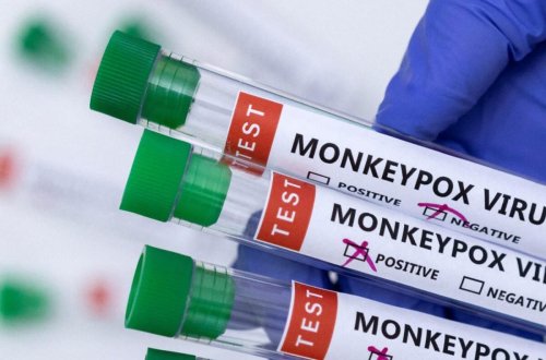 Azərbaycanda meymunçiçəyinin diaqnostikası və müalicəsi üçün bütün imkanlar var - RƏSMİ