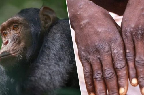 Avropa İttifaqı meymunçiçəyi ilə bağlı təcili tədbirlər görməyə tələsmir