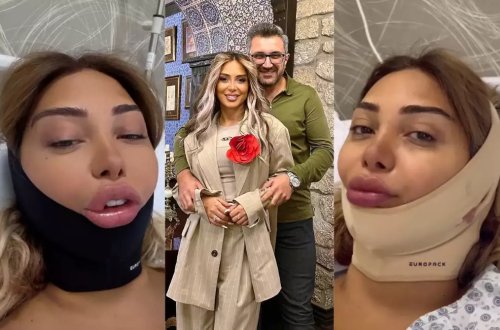 Çinarə buxağını kəsdirdi - FOTOlar