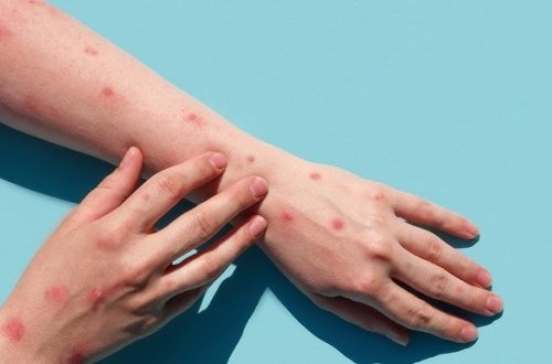 ÜST meymunçiçəyi ilə mübarizə üçün lazım olan məbləği açıqladı