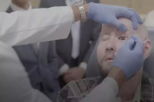 Dünyada ilk tam göz transplantasiyası reallaşıb