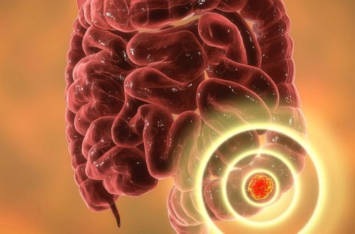 Bu xəstəlik artıq iyirmi yaşlaradək endi