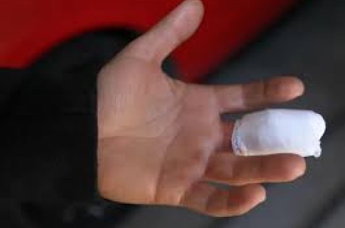 Rusiyada şok hadisə: Tanımadığı şəxs barmağını dişlədi, bir müddət sonra öldü