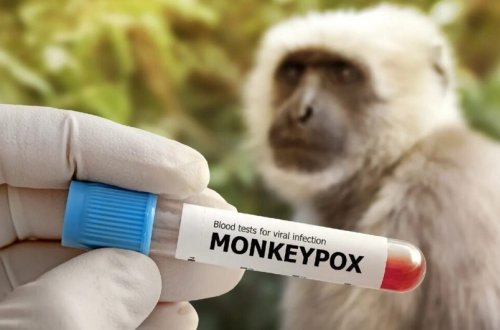 Meymunçiçəyi xəstəliyi ilə mübarizə üçün 3,6 milyon dozadan çox peyvənd ayrılıb