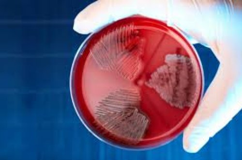 Honkonqda streptokokk infeksiyası partlayışı zamanı yoluxanların sayı kəskin artıb