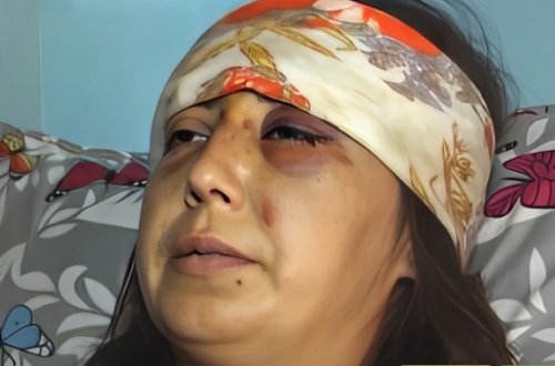 Bətnindəki körpənin cinsiyyəti qız olduğuna görə hamilə qadını döyərək uşağı tələf etdilər - VİDEO