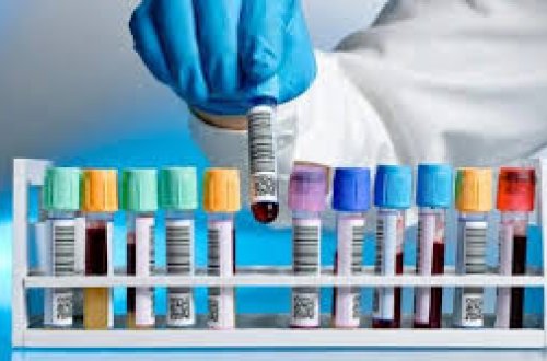 Azərbaycan çempionu dörd illik idmandan uzaqlaşdırıldı - SƏBƏB