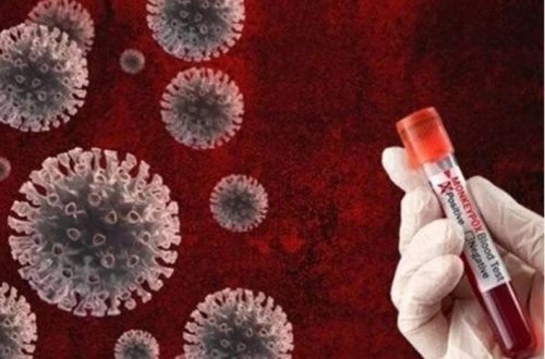 Konqoda 14 min insan Meymun çiçəyi virusuna qarşı peyvənd edilib